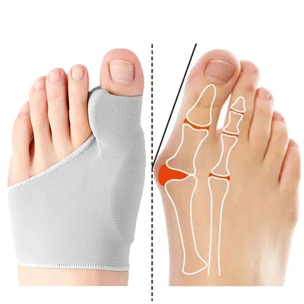 Ankle Brace Sock - 1/2 Pasang Pemisah Jari Kaki Hallux